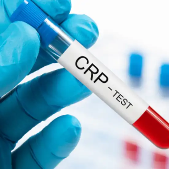 c-reactive protein crp qualitative test